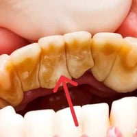 تنظيف اسنان • مجاني • واتساب