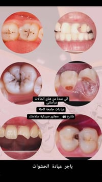 عمل مجاني • عيادة حشوات • شارع ٤٠