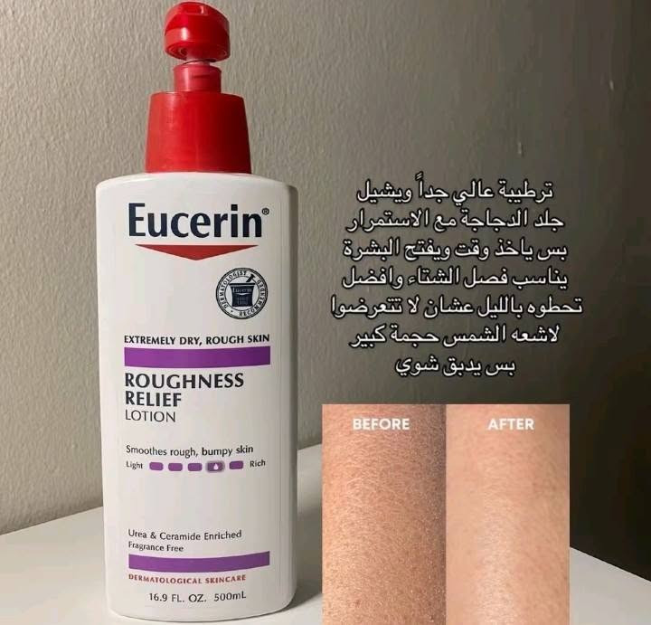 مرطب قوي • يزيل جلد الدجاجة • مناسب للشتاء