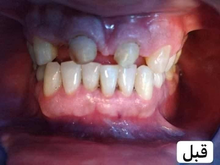 عيادة اسنان • تقويم وزراعة • تبييض ليزر