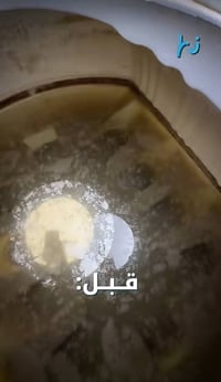 الشعلة • تنظيف تانكي • تعقيم طبي