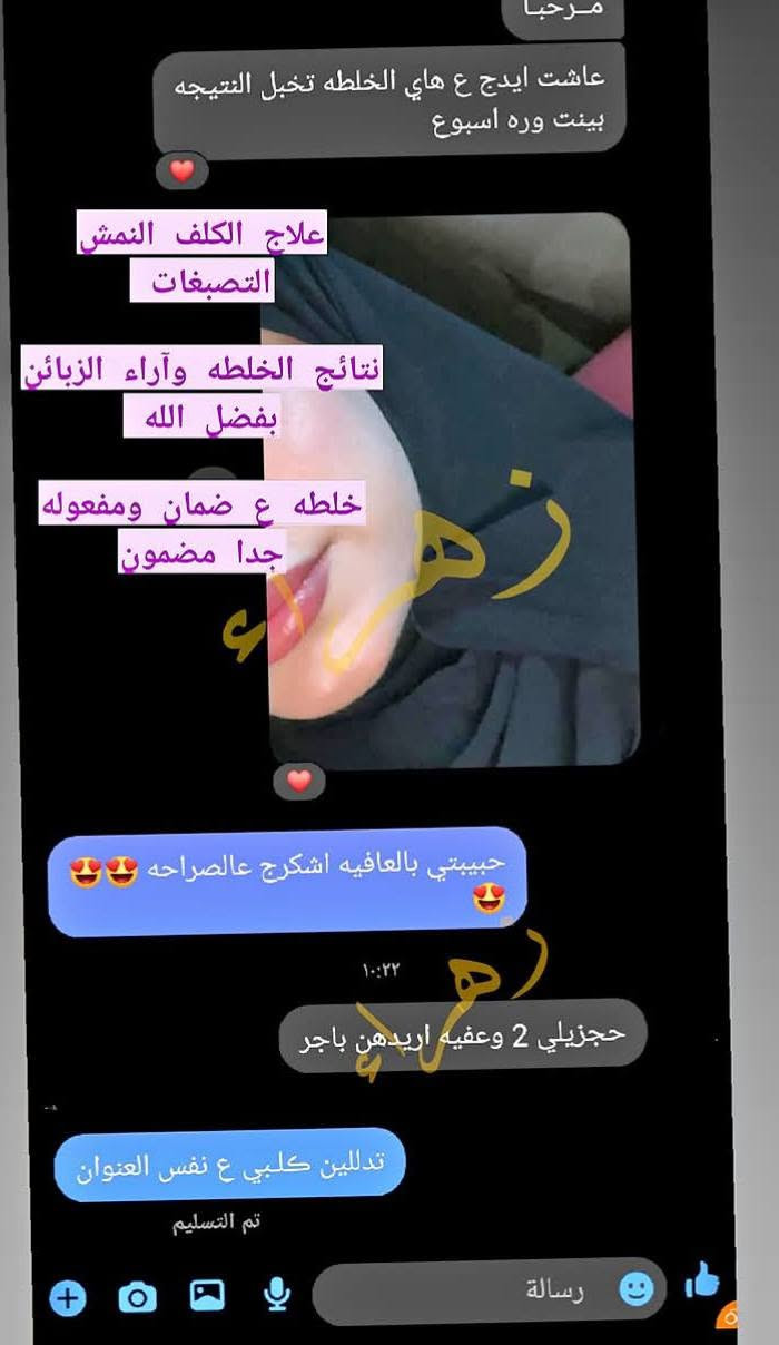 #الف رحمه على روح امه وابوه اليعلقلي هذا باب رزقي الوحيد #يارزاق ❤️
خلطة بشرة تجنن تسوي الوجه گيمر 
طبعا تستخدم للرجال ونساء 

#خلطه عباره عن كولاجين وفيتامينات  شغلها يخبل  وفوائده تجنن على بشره 

اي أضرار جانبية مابيها

تبيض  تصفيه   للكلف  للنمش  أثار حب شباب        

نتائجها  بعد  الاسبوع  الاول
 
خلطة + صابونه طبيه

للحجز مراسله الخاص او عالواتساب ***********
