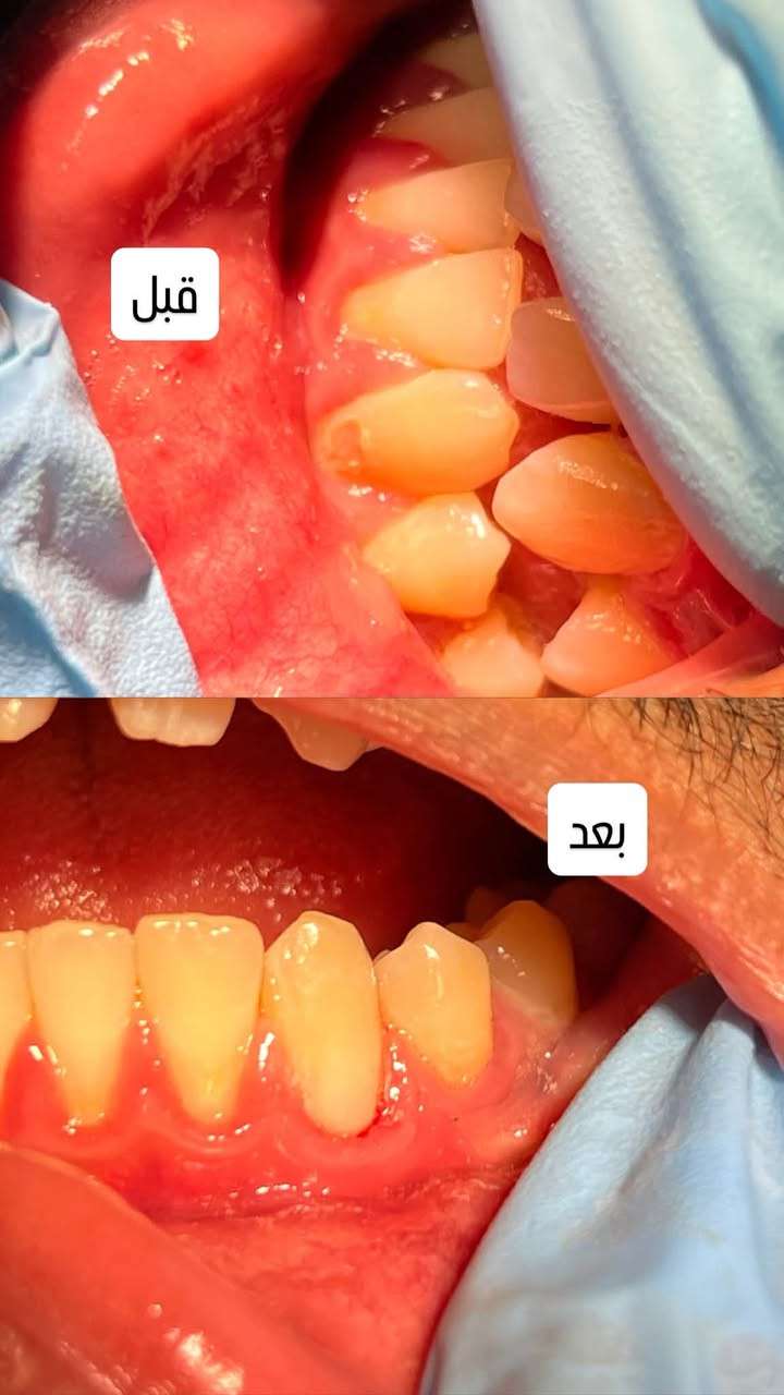 عيادة • حشوات اسنان • عزل