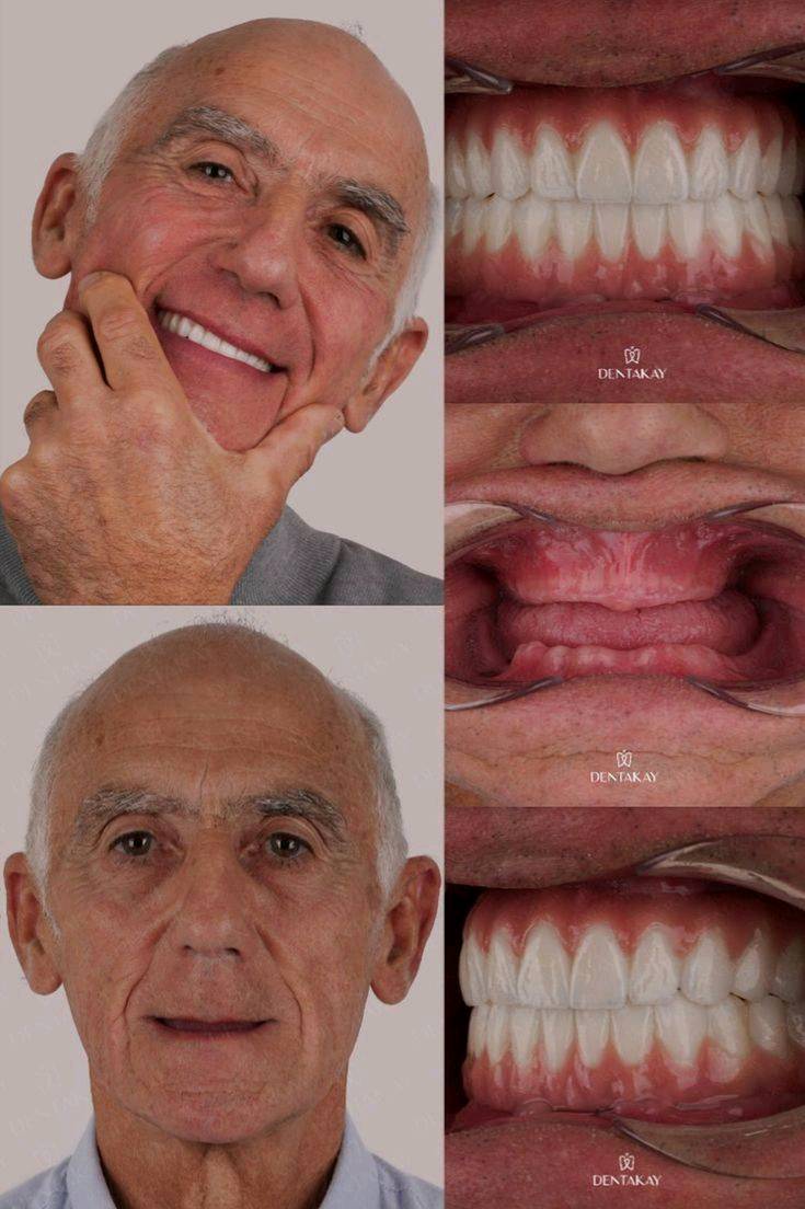 🚨🦷 خدمات أسنان مجــــانــــًا بالكامل! 🦷🚨

🎁 فرصة للاستفادة من خدمات طب الأسنان مجانًا:

🦷 طقم أسنان كامل للفك العلوي والسفلي — مجانًا
✨ حشوات ضوئية تجميلية للأسنان الأمامية — مجانًا
🦷 قلع الأسنان — مجانًا
🪥 تنظيف وإزالة تكلسات الأسنان — مجانًا

💥 نعم، الخدمات المذكورة أعلاه مجــــانــــيــــة!

📍 كربلاء – شارع الحر الصغير
🏥 عيادات أهل البيت التخصصية

📞 للحجز والاستفسار:
***********

⏳ الحجز مسبقًا والأماكن محدودة.