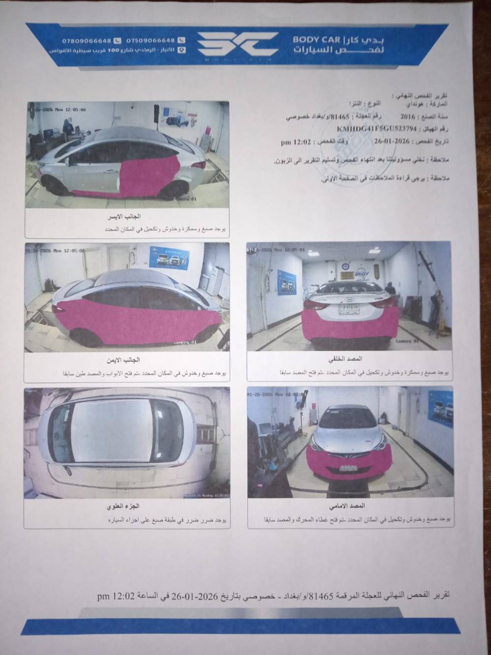 النترا • ٢٠١٦ • رقم بغداد