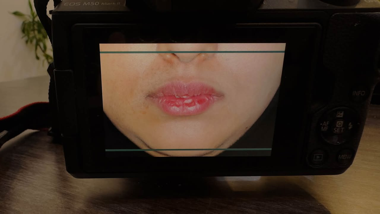 دكتورة جمانة • عيادة القريشي • EOS M50