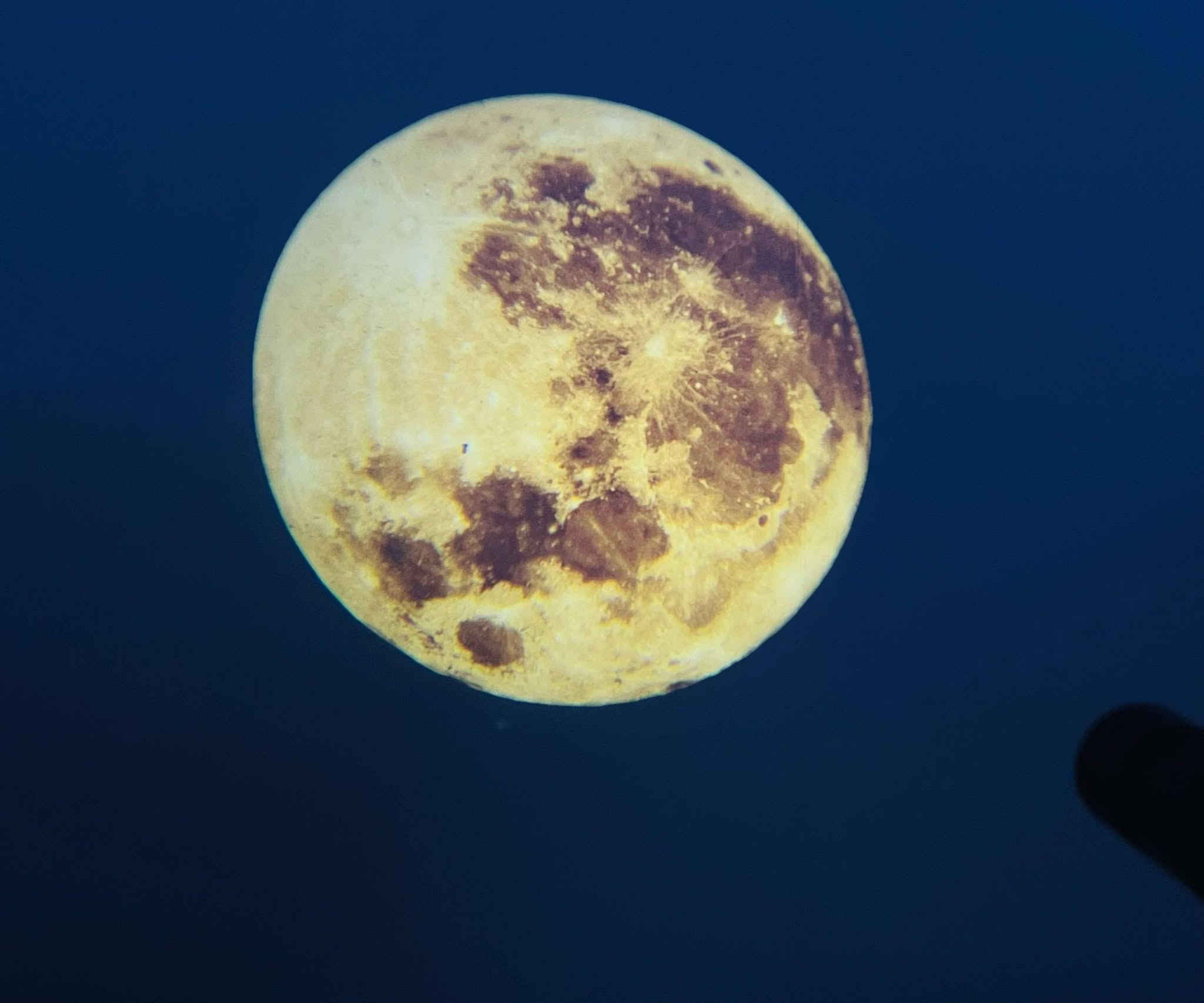 بلاجكتور ضوء القمر سعر 19 الف 
وتوصيل لباب البيت💌

للحجز واتساب::: ***********
