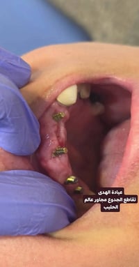 عيادة الهدى • طب الأسنان • تجميل