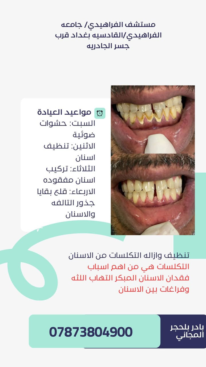 جامعه الفراهيدي قرب جسر الجادريه.

للحجز ***********

نص مكتوب في الصور:
- مستشفى الفراهيدي/ جامعه الفراهيدي/القادسيه بغداد قرب جسر الجادريه dr- Hajer لعلاج كافه مشاكل الاسنان بفحص وعلاج مجاني تحت اشراف نخبه من افضل الاطباء مواعيد العيادة السبت: حشوات ضوئية الاثنين: تنظيف اسنان الثلاثاء: تركيب اسنان مفقوده الاربعاء: قلع بقايا جذور التالفه والاسنان *********** بادر بلحجر المجاني
- مستشف الفراهيدي/ جامعه الفراهيدي/القادسيه بغداد قرب جسر الجادريه مواعيد العيادة السبت: حشوات ضوئية الاثنين: تنظيف اسنان الثلاثاء: تركيب اسنان مفقوده الاربعاء: قلع بقايا جذور التالفه والاسنان ازاله مختلف انواع التسوسات وبناء حشوات ضوئيه بادر بلحجر المجاني ***********
- مستشف الفراهيدي/ جامعه الفراهيدي/القادسيه بغداد قرب جسر الجادريه مواعيد العيادة السبت: حشوات ضوئية الاثنين: تنظيف اسنان الثلاثاء: تركيب اسنان مفقوده الاربعاء: قلع بقايا جذور التالفه والاسنان تنظيف وازاله التكلساات من الاسنان التكلساات هي من اهم اسباب فقدان الاسنان المبكر التهاب اللثه وفراغات بين الاسنان *********** بادر بلحجر المجاني
- مستشف الفراهيدي/ جامعه الفراهيدي/القادسيه بغداد قرب جسر الجادريه مواعيد العيادة السبت: حشوات ضوئية الاثنين: تنظيف اسنان الثلاثاء: تركيب اسنان مفقوده الاربعاء: قلع بقايا جذور التالفه والاسنان تعويض الاسنان المفقوده مجاناً *********** بادر بلحجر المجاني