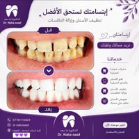علاج أسنان مجاني • تنظيف الأسنان • كلية السلام السيدية