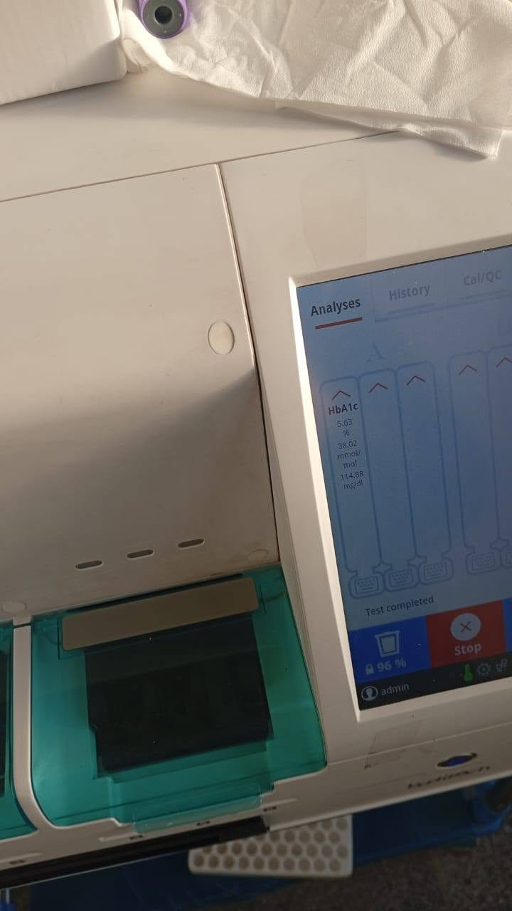 السلام عليكم
مختبر كامل للبيع 
1-semi Auto chemistry mindary 
2-afias 6 
3-waterbath
4-centrifuge عدد2
5-microcentrifuge
6-electron microscope 
7-normal microscope عدد2
8-medonic CBC 3 part 
9-كرسي سحب 
كل الأغراض و الاجهزة هي استعمال شهر و اكو اقل من الشهر 
سبب البيع ظروف خاصة 
الموقع بغداد 
للتواصل عبر الخاص أو عبر الرقم ***********
