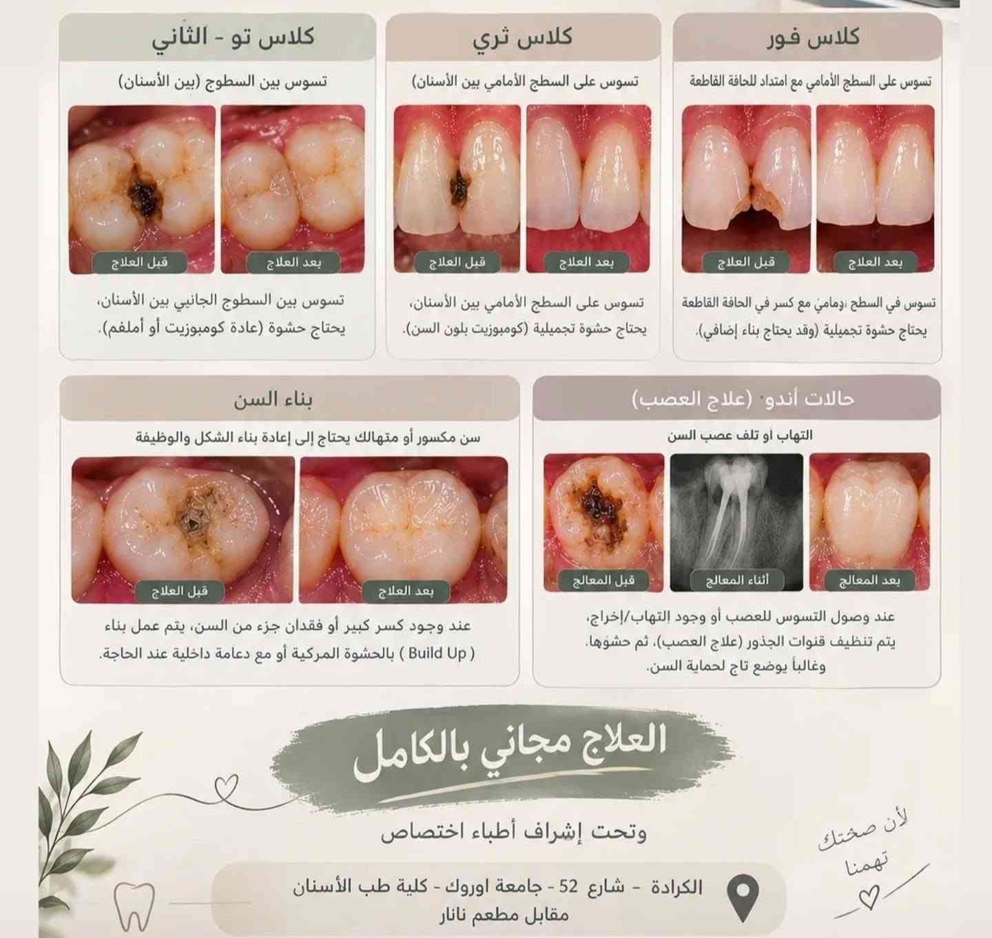 علاج أسنان مجاني • الكرادة شارع ٥٢ • أسنان أطفال