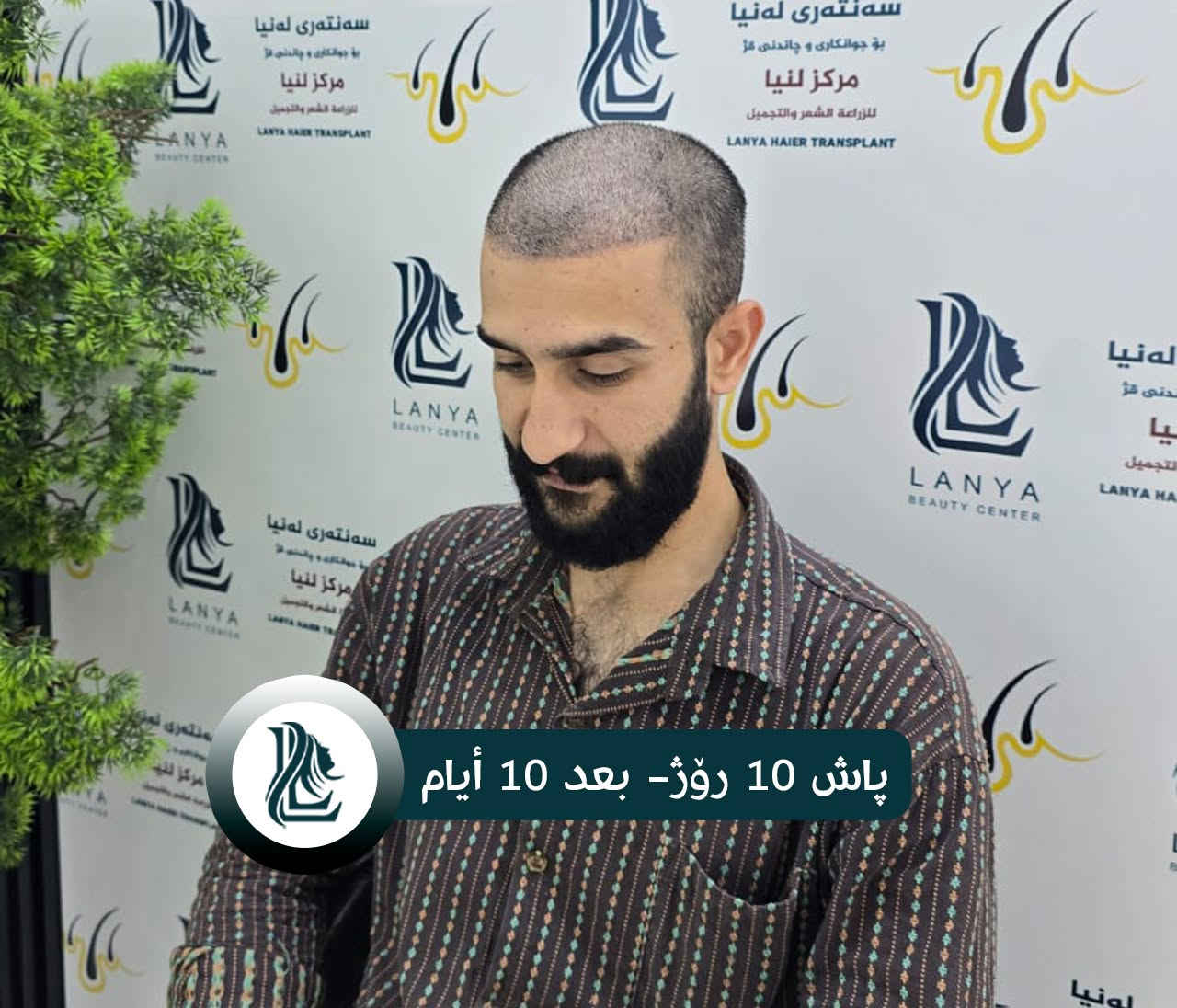 *ودّع فراغات الشعر، واستقبل إطلالة جديدة*
حلول متقدمة ونتائج تدوم.
♦ مع لەنیا حافظ على شبابك.
📍 العنوان:كلار - شارع ليوا - قرب جامع بخاري
📞 رقم التواصل:
***********
🔸🔸🔸🔸🔸🔸
چاندنی قژ لە لەنیا، هەنگاوێک بۆ دڵنیایی و جوانی زیاتر.
🔹 ئەنجامی چاندنەوەی قژی بێ وێنە و ناوازە هەموو کات لە سەنتەری لەنیا دەبینرێت
♦ لەگەڵ لەنیا هەمیشە بەگەنجی دەمێنێتەوە
📍 ناونیشان: کەلار- شەقامى لیواکە - نزیک مزگەوتی بوخاری
📞 ژمارەی پەیوەندی: ***********
