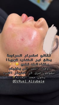 عروض شهر التاسع • ابر النضارة • نتيجة أول جلسة