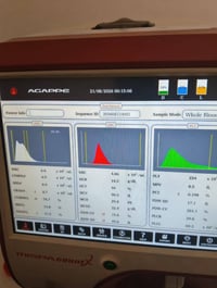 جهاز cbc Mispa للبيع جديد مشتغل 1170 فحص موديل 24 للبيع جهاز cbc Mispa...