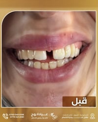 عيادة روح • تجميل أسنان • المحمودية