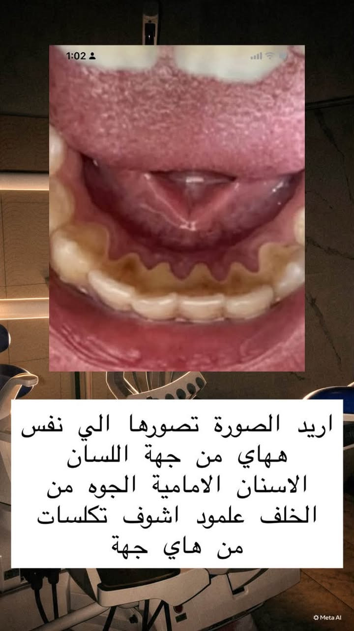 علاج اسنان مجاني • الجبيلة البصرة • عيادات الكنوز
