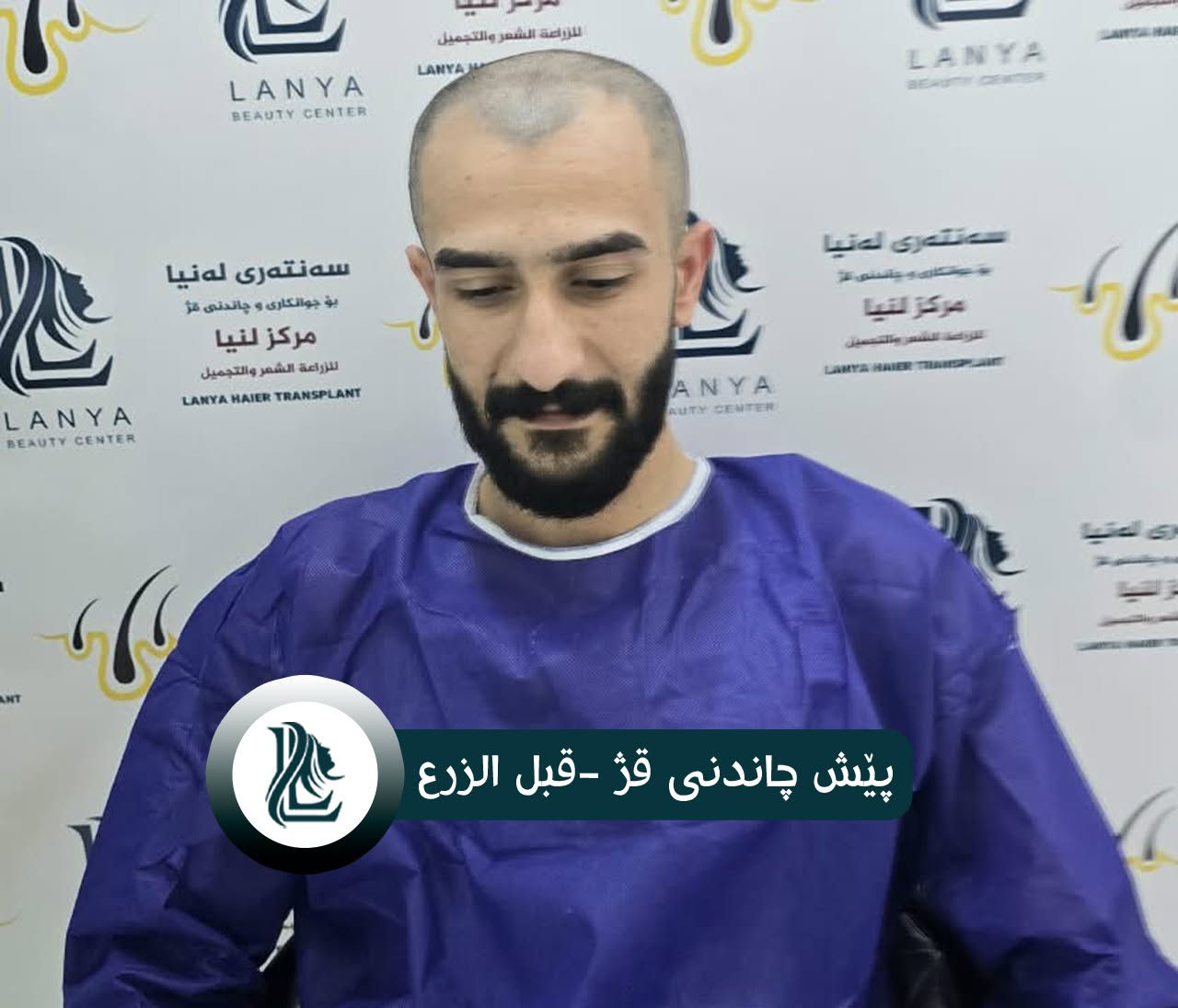 *ودّع فراغات الشعر، واستقبل إطلالة جديدة*
حلول متقدمة ونتائج تدوم.
♦ مع لەنیا حافظ على شبابك.
📍 العنوان:كلار - شارع ليوا - قرب جامع بخاري
📞 رقم التواصل:
***********
🔸🔸🔸🔸🔸🔸
چاندنی قژ لە لەنیا، هەنگاوێک بۆ دڵنیایی و جوانی زیاتر.
🔹 ئەنجامی چاندنەوەی قژی بێ وێنە و ناوازە هەموو کات لە سەنتەری لەنیا دەبینرێت
♦ لەگەڵ لەنیا هەمیشە بەگەنجی دەمێنێتەوە
📍 ناونیشان: کەلار- شەقامى لیواکە - نزیک مزگەوتی بوخاری
📞 ژمارەی پەیوەندی: ***********
