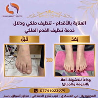 سنتر الشمس • عناية شعر وبشرة • المحمودية حي العسكري