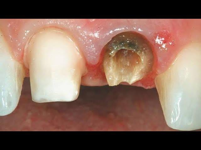 ابتسامتك تستحق عناية تليق بها
نقدّم لكم خدمات طب الأسنان في عيادات طب الأسنان - جامعة الكوفة، باهتمام ودقة وحرص على راحتكم.
خلف كلية الفقه
نظيف الأسنان وازالة التكلسات
حشوات تجميلية
تعويض الأسنان المفقودة
قلع الأسنان التالقة
والجذور المتبقية
***********
n.our.1_

نص مكتوب في الصور:
- drgabrielwahyudi