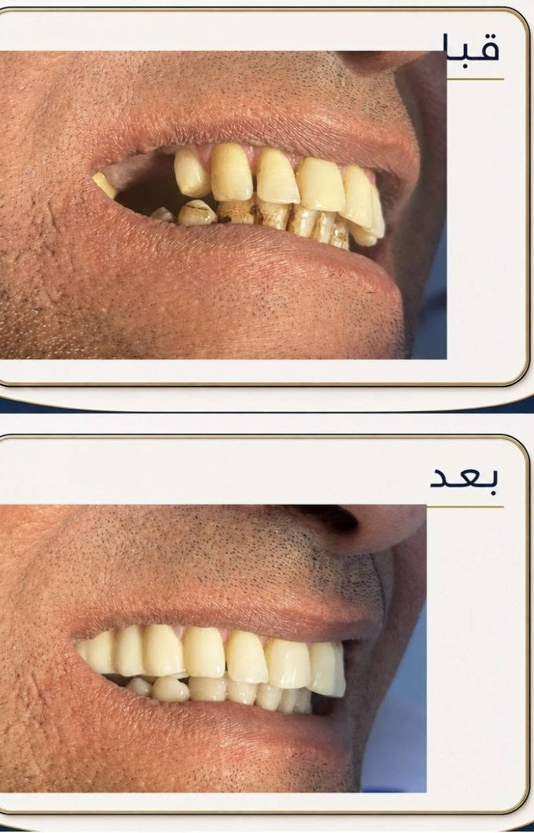 عيادة الهدى • أسنان وتجميل • تقاطع الجدوع