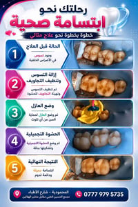 ٣ حشوات • تقنية الطبعة • عيادة زومو
