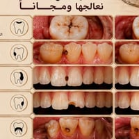 علاج مجاني • تنظيف جير • حشوات تجميلية