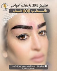 زراعة الحاجب • نتائج مضمونة • النجف