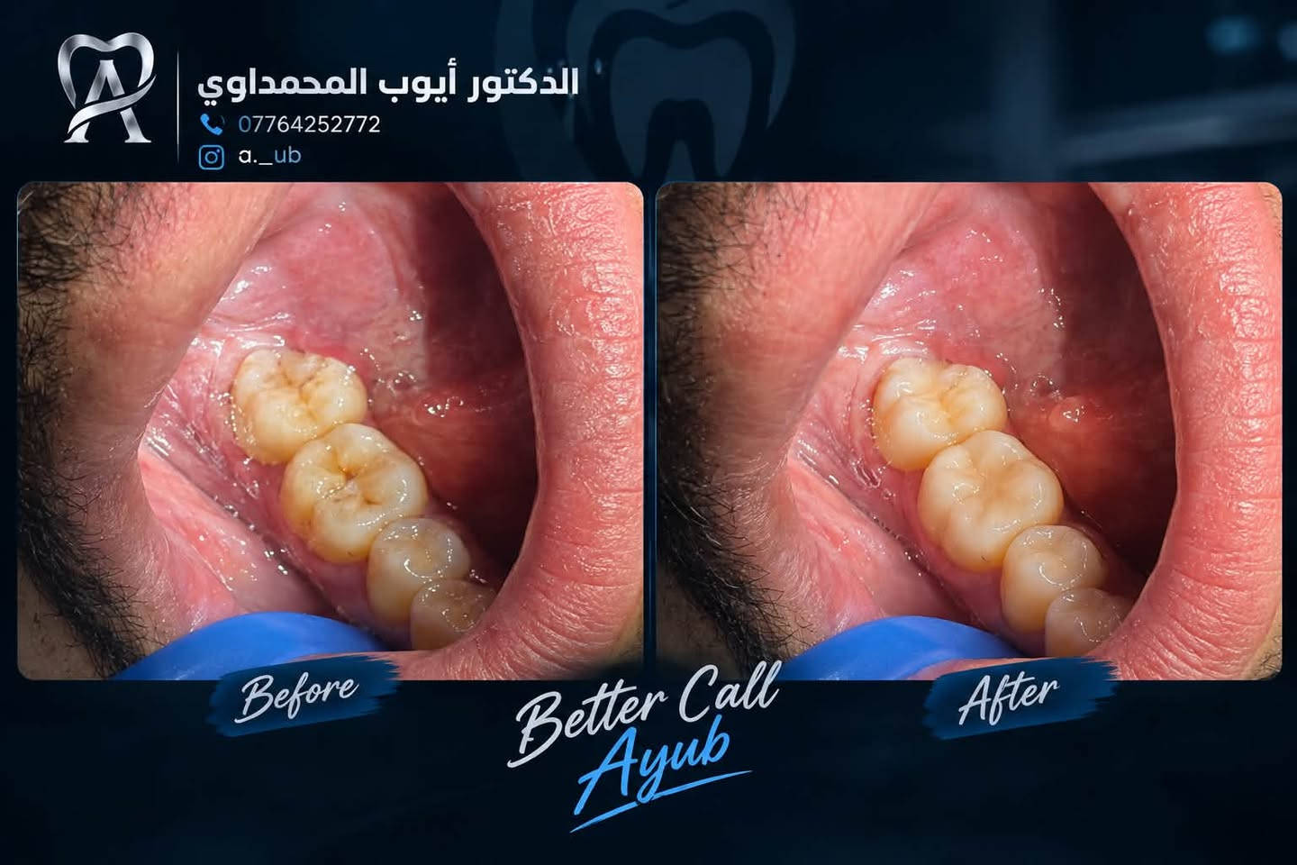 تركيبات أسنان • تنظيف وتبييض • علاج مجاني