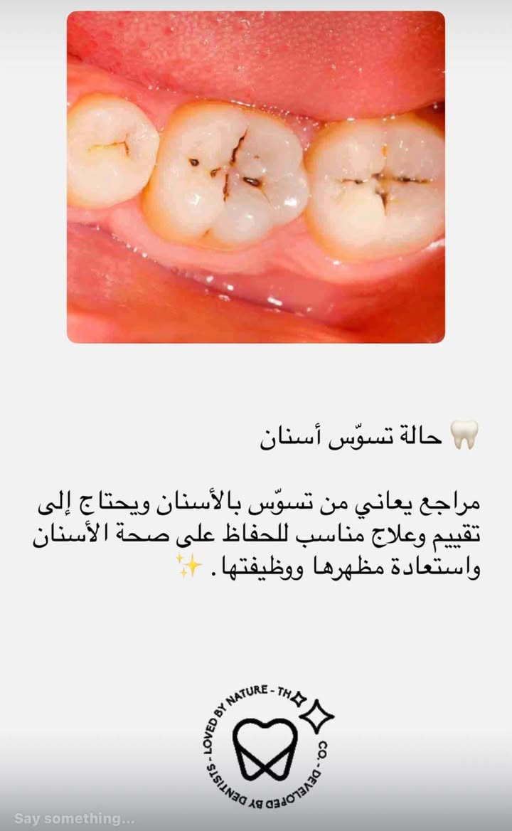 علاج مجاني • تحت إشراف طبي • جامعة اوروك