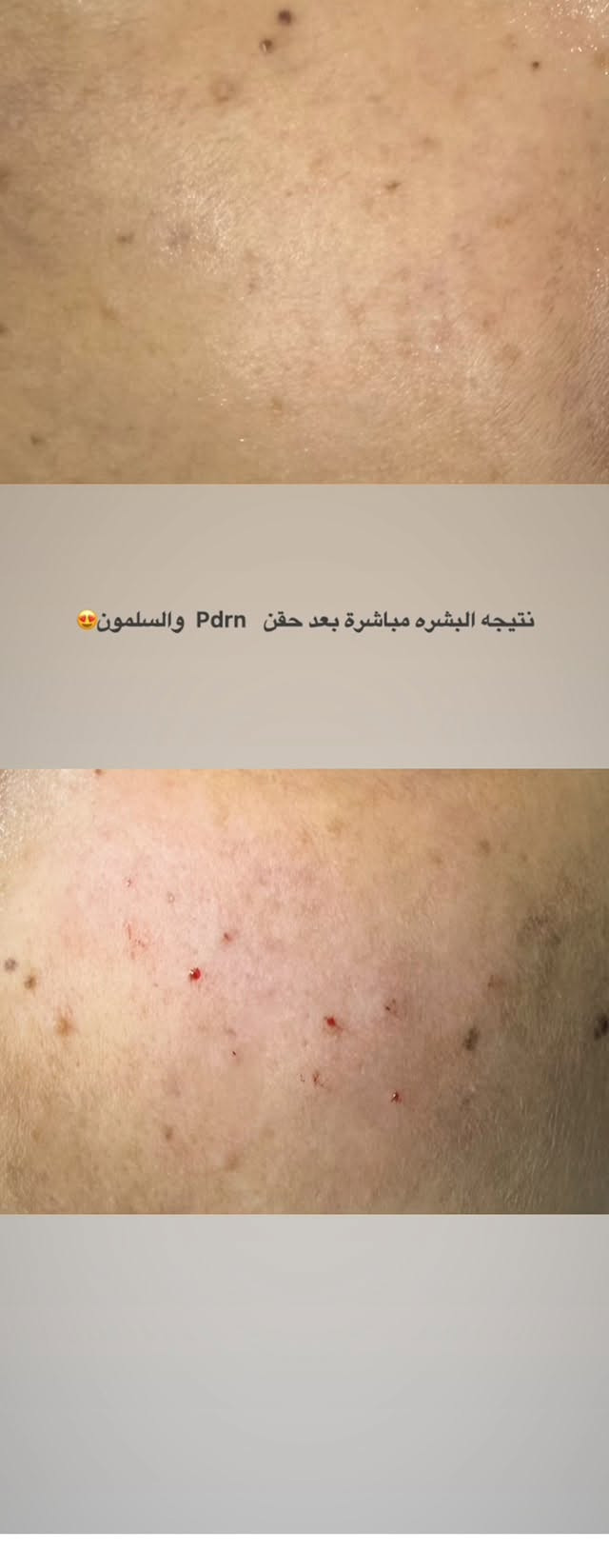 ننتضركم يوميا في عيادة كنز الابتسامه من الساعه ٥ للساعه ٩ مساءا للحجز والاستفسار واتس *********** عنوان العيادة نزلة گميره فوق صيدليه ليث صباح مقابل علوة ابو محمد
