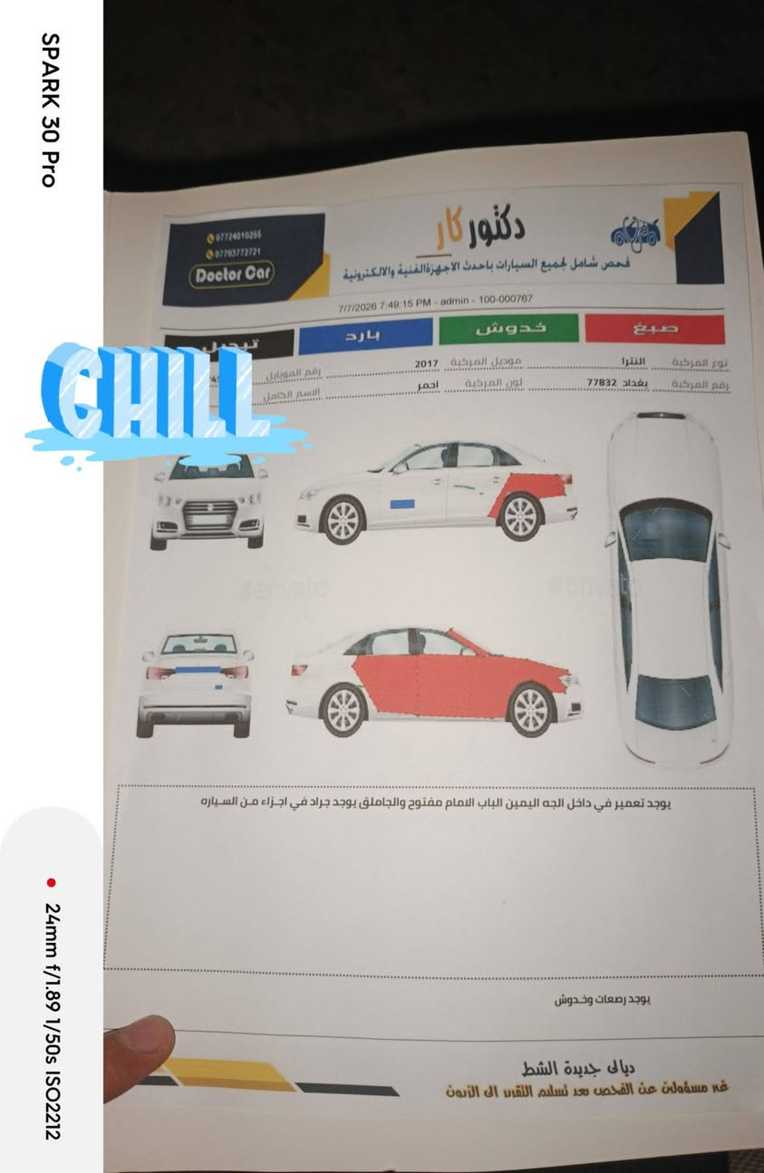 السلام عليكم النترا 2017 وارد امريكي السياره بها ابابتين الجهه الصدر واللي وراها و وبيها جامرلوغ خلفي وامامي حادث من امريكا سياره بدون دواخل وبدون ارباك وبدون بجم سياره رقمها بغداد سنويه ل 28 شهر الثامن سياره اي نقص ما بيها عنوان السياره ديالى الخالص الرقم ***********
السلام عليكم النترا 2017 وارد امريكي السياره بها ابابتين الجهه الصدر واللي وراها و وبيها جامرلوغ خلفي وامامي حادث من امريكا سياره بدون دواخل وبدون ارباك وبدون بجم سياره رقمها بغداد سنويه ل 28 شهر الثامن سياره اي نقص ما بيها عنوان السياره ديالى الخالص الرقم ***********
السعر 110 وبيها مجال قليل مرفق وياها السونار
