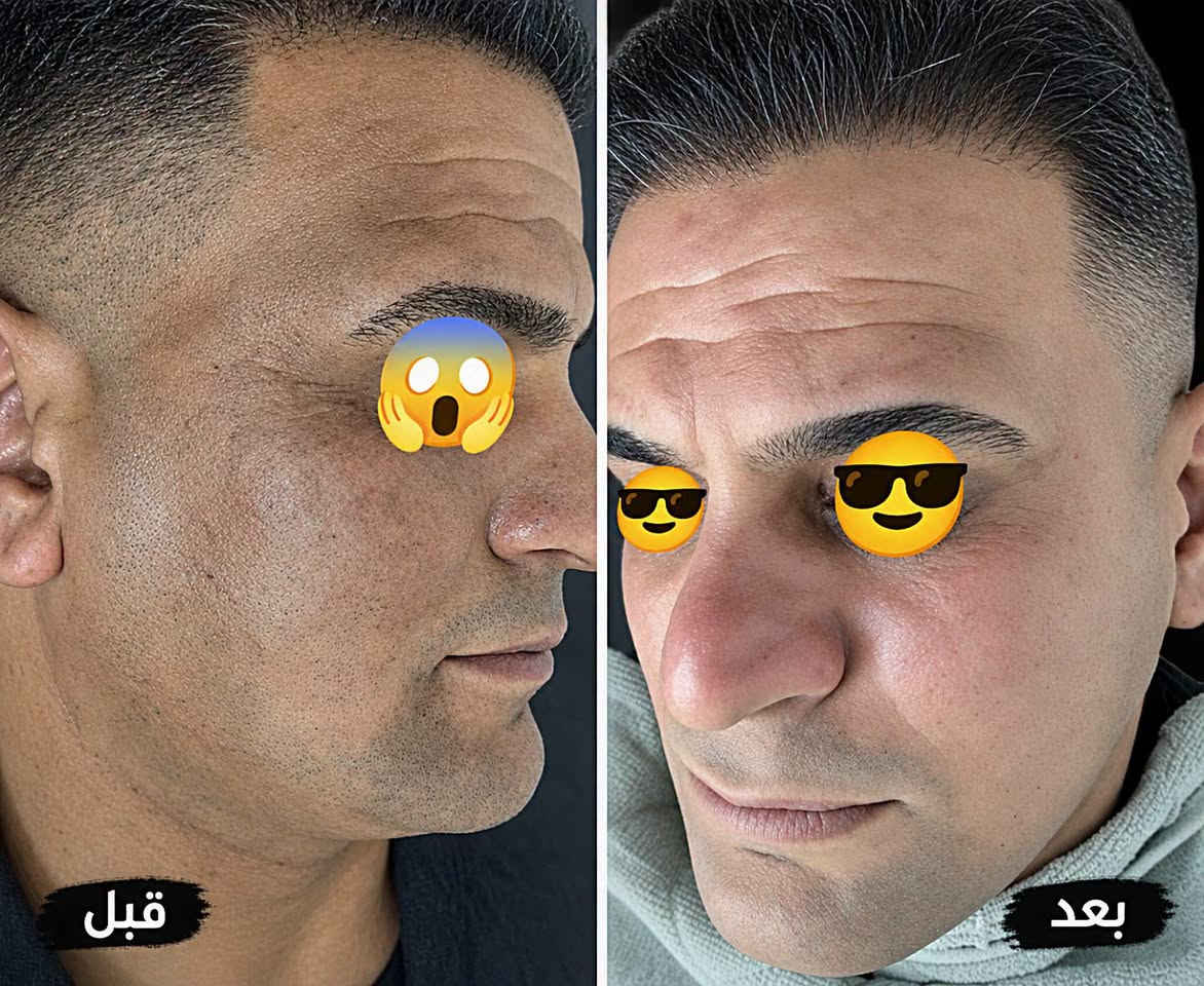 للحجز مراسلة الصفحه
واتساب ***********
واتساب ***********
وبخدمتكم بكل وقت ❤️
@الجميع

نص مكتوب في الصور:
- قبل
- بعد
- كوافير كمر للعناية بالرجل
- ***********
- ***********
- كمر
- تامر
- طمر