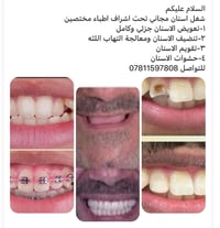 شغل اسنان مجاني • تعويض اسنان • تنظيف اسنان