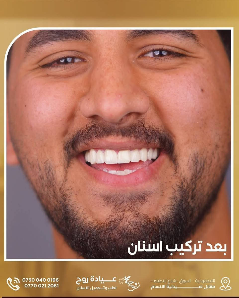 عياده روح لطب وتجميل الاسنان 
د.زهراء صادق 
"لأن ابتسامتك عنوان جمالك، نوفر لك في عيادة روح لطب الأسنان أحدث التقنيات للحصول على ابتسامة مثالية ✨. 

زورونا في المحمودية - شارع مقابل صيدلية الأنسام للحصول على العناية التي تستحقها. 
📞 للحجز والاستفسار: 
*********** 
*********** 

#ابتسامتكم_يحتاجلها_روح⭐️
