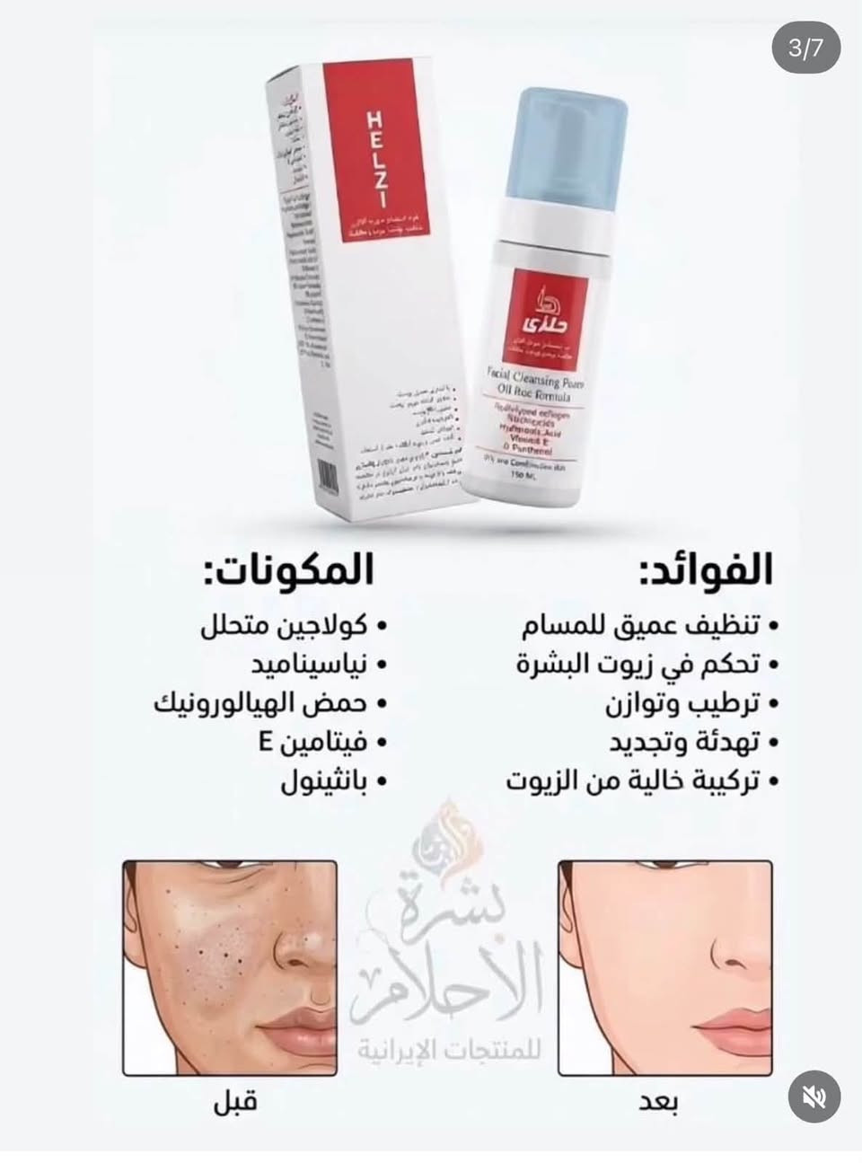 سلام عليكم
متوفر الكريم القدم  bms

500 درزن

متوفر 37 آيتمات من لشركةbms 

متوفر من الشركة الحلزي كلشي منهه 

الاسعار اتصل ع الواتساب و تدلل

اللة يرزق الجميع 

***********

٠٩١٣٤٦٢٦٩٨٥

واتساب

نص مكتوب في الصور:
- بكج العناية بالجسم الجم بشرة أنعم .. جسم أكثر إنتعاشاً بمكونات طبيعية تغذية البشرة ترطيب عميق غسول الوجه بزيت الأركان ينظف البشرة بلطف ويزيل الشوائب يحافظ على توازن الجلد الطبيعي يرطب ويمنح إحساساً بالنعومة لبشرة نظيفة .. ومشرقة دائماً مناسب لجميع أنواع البشرة لوشن الجسم بزيت الأركان يرطب بعمق ويغذي البشرة يمنح نعومة ولمسة حريرية يحافظ على مرونة الجلد مناسب للاستخدام اليومي لجسم ناعم ومرطب طوال اليوم مناسب لجميع أنواع البشرة كريم الأركان للجسم ترطيب عميق للبشرة الجافة يغذي ويعيد حيوية البشرة يحسن مرونة ونعومة الجلد يحمي من الجفاف والتشقق بشرة ناعمة .. ومغذية مناسب لجميع أنواع البشرة
- بعد الاستخدام قبل الاستخدام Before Use After بشرة الاحلام للمنتجات الإيرانية محتويات البكج 1. غسول وجه رغوي 2. كريم مرطب 3. سيروم للوجه 4. سيروم للعين 5. واقي شمسي الفوائد والمكونات ومكوناته كولاجين الحلزون يعمل على تجديد الخلايا، مكافحة الشيخوخة، وتحسين مرونة البشرة. حمض الهيالورونيك يرطب البشرة بعمق ويحبس الرطوبة، مما يجعلها ممتلئة وناعمة. نياسيناميد يفتح لون البشرة، يوحد لونها، ويقلل من مظهر المسام والعيوب. فيتامين B5 يغذي البشرة، يهدئ الالتهابات، ويقوي الحاجز الواقي الطبيعي للبشرة.
- 7/7
- المكونات
- مستخلص الحلزون النقي
- كولاجين بحري
- حمض الهيالورونيك
- فيتامين E
- الفواءد
- ترطيب عميق ومكثف يدوم 24 ساعة
- تجديد خلايا البشرة وتأخير الشيخوخة
- تحسين مرونة البشرة وتقليل التجاعيد
- فتتيح وتوحيد لون البشرة
- تهدئة البشرة وعلاج الالتهابات
- قبل وبعد
- بشرة الأحلام
- للمنتجات الإيرانية
- بعد
- قبل
- 3/7 المكونات: • كولاجين متحلل • نياسيناميد • حمض الهيالورونيك • فيتامين E • بانثينول الفوائد: • تنظيف عميق للمسام • تحكم في زيوت البشرة • ترطيب وتوازن • تهدئة وتجديد • تركيبة خالية من الزيوت قبل نشرة الأحلام للمنتجات الإيرانية بعد
- كريم مرطب ومنعم للبشرة يحتوي على زيت الأركان والأوميغا 3 يمكن استخدامه للوجه، اليدين، والجسم.
- BMS NATURAL CARE FOR YOUR BEAUTY Micellar Cleansing Water للبشرة الجافة والحساسة ينظف البشرة بلطف ويزيل الشوائب والأوساخ يزيل المكياج بفعالية من الوجه والعيون والشفايف يساعد على تهدئة البشرة ويقلل من الاحمرار والتهيج يحافظ على توازن البشرة ويمنحها الترطيب ما يحتاج غسل بالماء مناسب للاستخدام اليومي مناسب للبشرة الجافة والحساسة مختبر أماميا جلدياً غير مجرب على الحيوانات خالى من البارابين نظافة ونعومة في خطوة واحدة
- ماسك الذهب والأكسجين من BMS - لنضارة فورية وتفتيح عميق للبشرة
- الغسول الأسود بالفحم - Charcoal يستخدم للبشرة الدهنية ينظف بعمق وتقشير خفيف يسحب الدهون الزايدة والأوساخ من المسام ويقلل اللمعان الناتج من تراكم الدهون
- كريم مرطب ومعزز بخلاصة الصبار (ألوفيرا)، مصمم خصيصاً لتوفير ترطيب عميق وحماية للبشرة. يساعد في تحسين مرونة الجلد وتجديد الخلايا، مما يساهم في تأخير ظهور التجاعيد وعلامات الشيخوخة