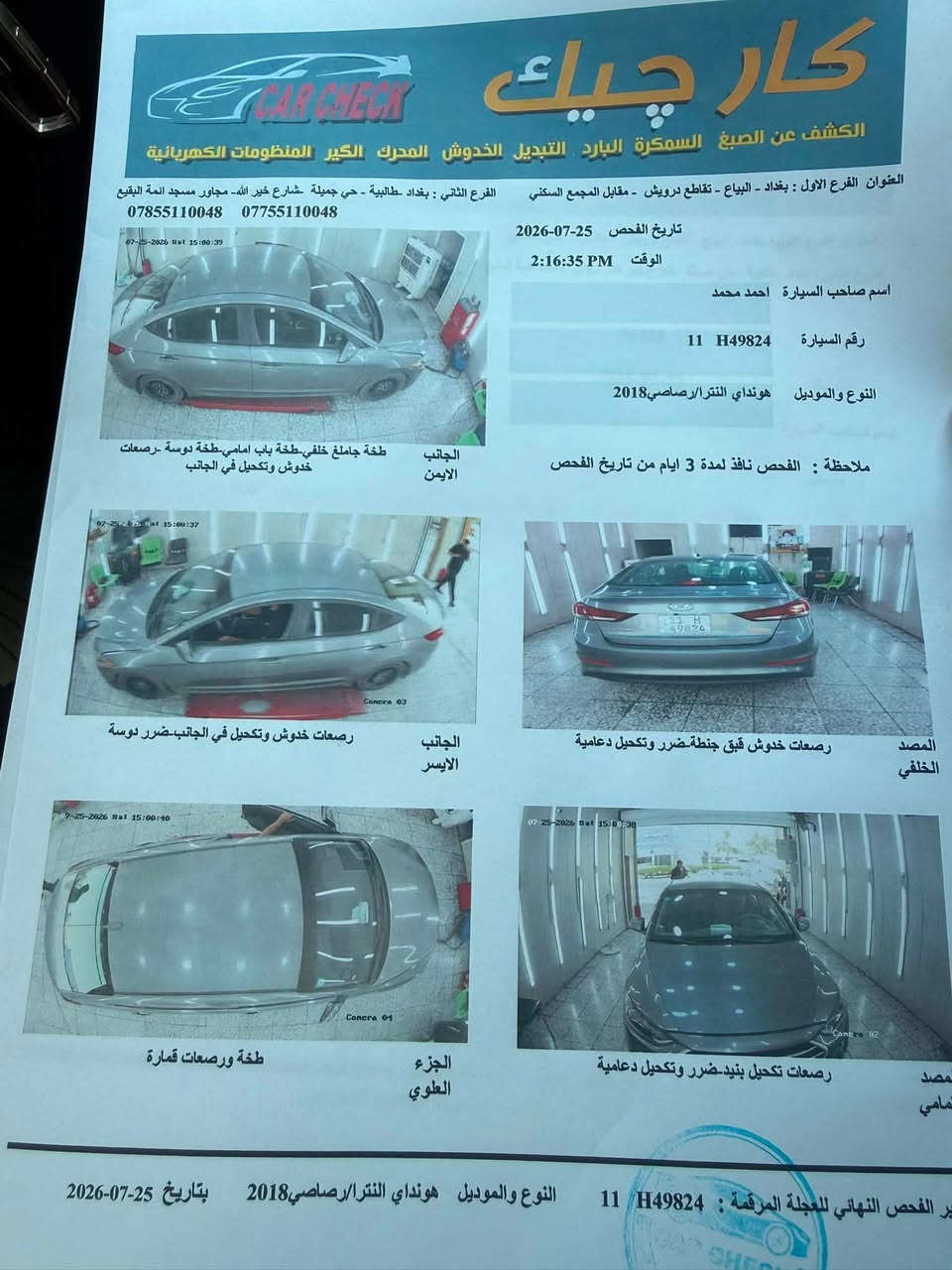 النترا ١٨ سياره داخله آكلين
بدون قطرت صبغ كير محرك مكفول 
ماشيه ٧٩ 
شاشه ابلادي 
رادار جانبي 
سعر ١٢٠ بيه مجال 
رقم ***********
