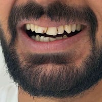 مركز أسد • تجميل أسنان • المدائن