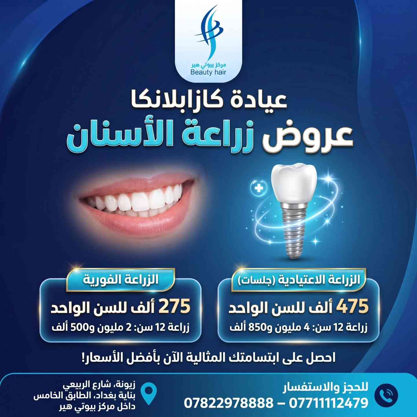 ابتسامة هوليوود • زراعة أسنان • زيونة