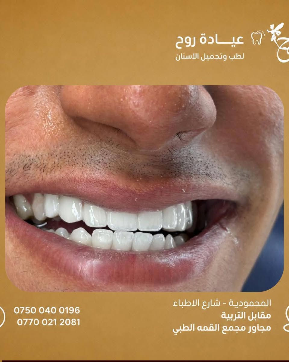 عياده روح لطب وتجميل الاسنان د.زهراء صادق 

المحموديه شارع الأطباء مقابيل التربيه مجاور مجمع القمه الطبي عياده روح  للأسنان 
للاستفسار 
***********
