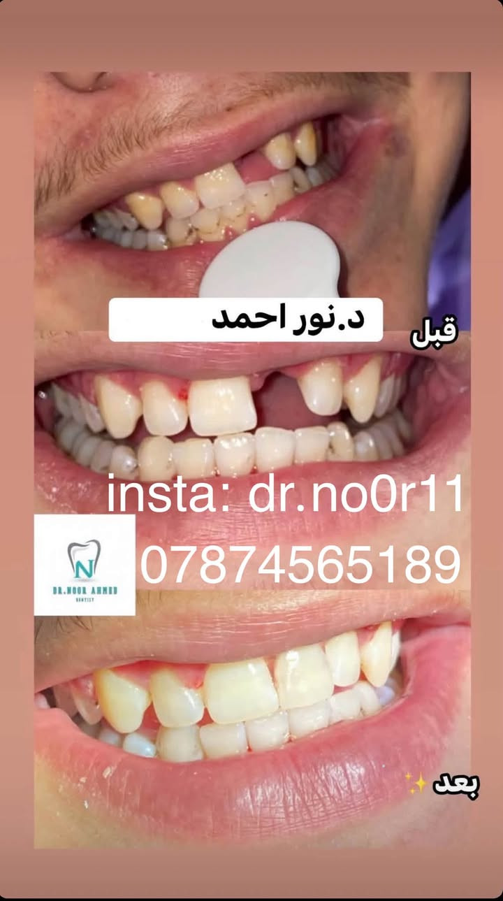 خدمات أسنان مجانية • تقويم متحرك • حله شارع ٤٠