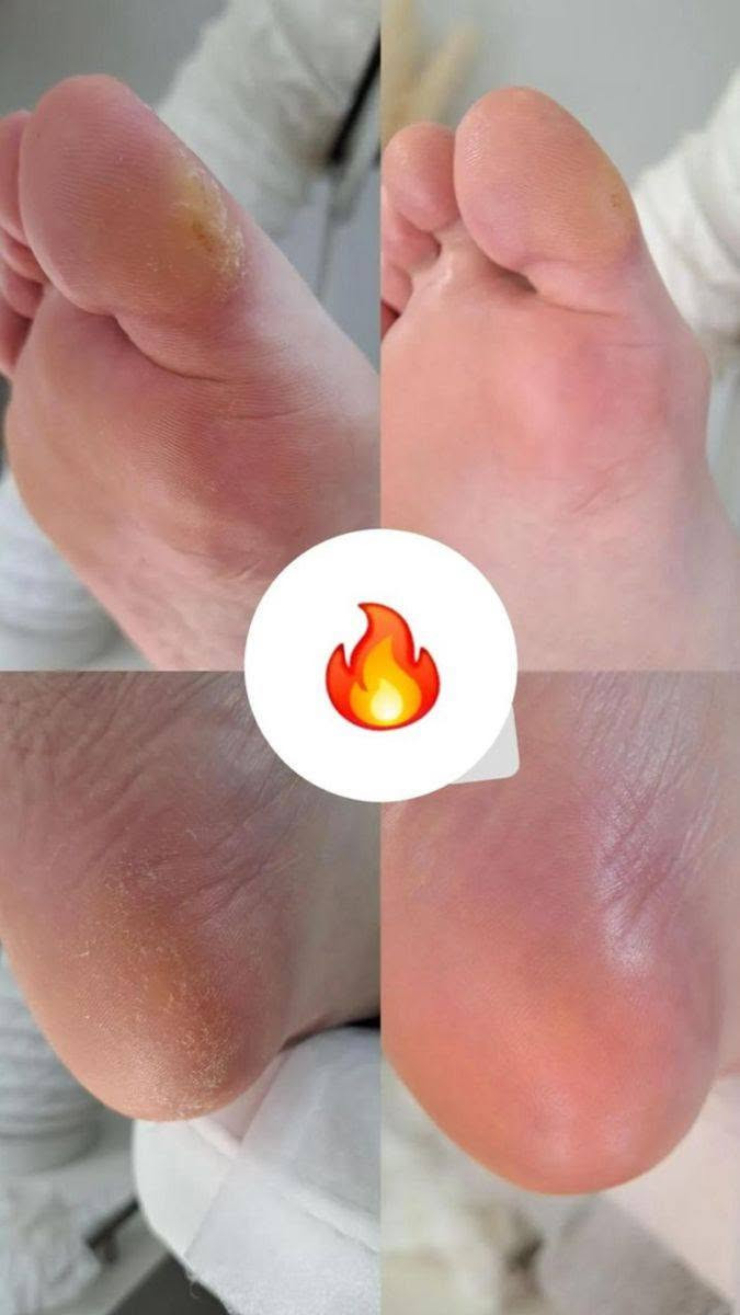 بنات خدمه منزليه نجيكم للبيت
شيرة جسم كامل + مقشر للجسم 
حفافه وجه
تنضيف بشره
 تنضيف قدم
كل ه̷̷َـَْـُذآ ب50 الف 
وحده الكروه عليج اكثر م̷ـــِْن وحده الكروه علينه

للحجز واتساب
***********
