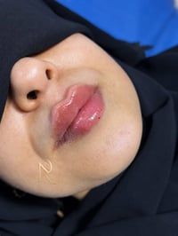 فلر شفة • ١ سي سي • الناصرية