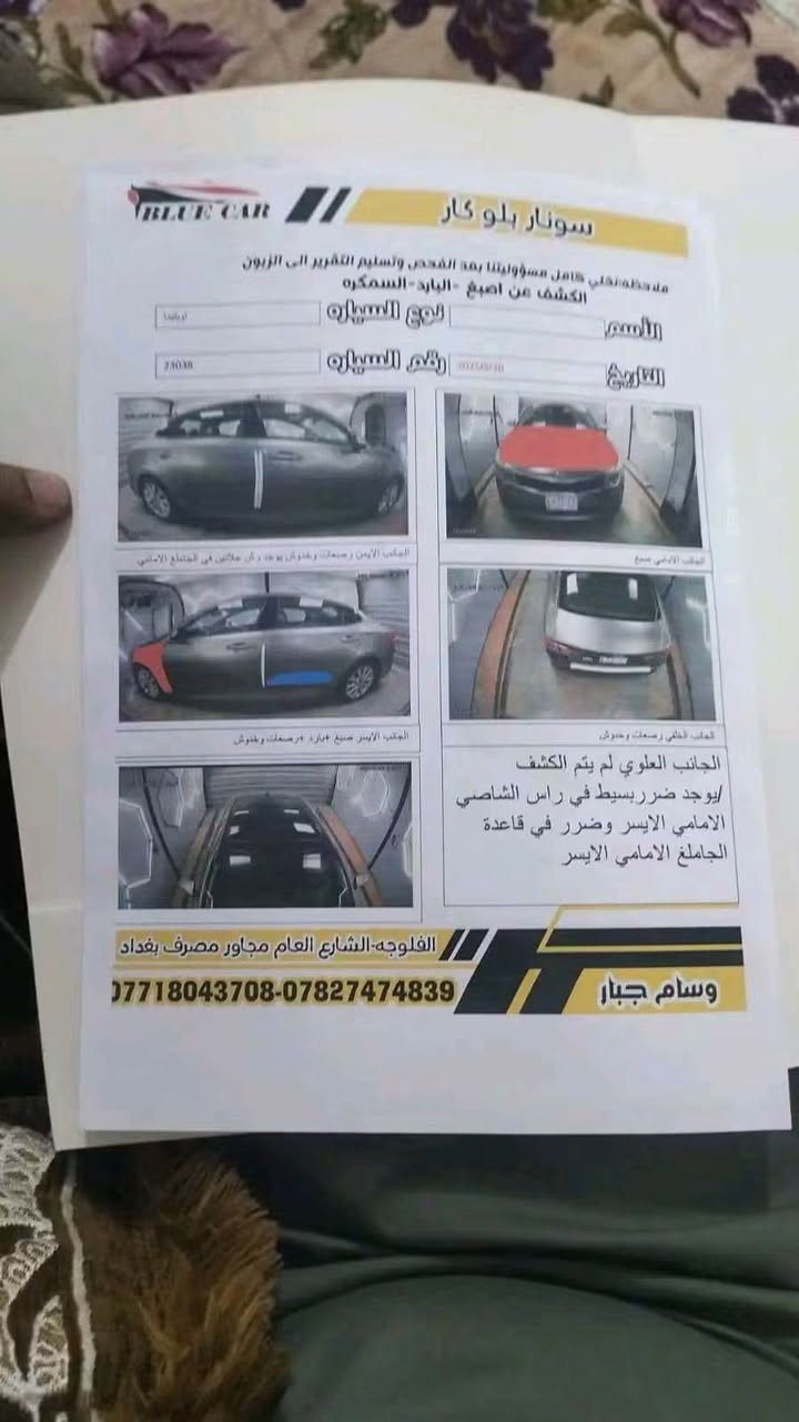 كيا اوبتيما 2018

ارقام بغداد، سنوية جديدة، تحويل مباشر
كامل مواصفات

محرك كير خير من الله
صدر جديد

مري قلاب
تبريد قطعتين
تحديد سرعة
اشارة بالمرايه

سيارة اقتصادية موثوقة، خيار مناسب للاستخدام اليومي العائلي براحة وامان

الحادث مرفق مع الصور بالسونار

مكان السيارة: الانبار، الفلوجة
بيع مستعجل

للتواصل: ***********

السعر: 🟧 السعر علق يوصلك السعر 📮

#اوبتيما_2018 #الفلوجة #بيع_سيارات

نص مكتوب في الصور:
- *********** - ***********