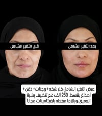 فلر كوري • هايدروفيشل • حي الجزائر