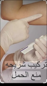 الشماعيه • طبيبة نسائية وتوليد • تركيب شريحة