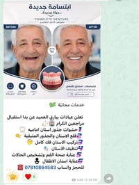 عيادات بيارق العميد • طقم اسنان كامل • خدمات مجانية