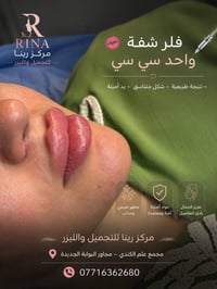 فيلر شفة • ليزر إزالة تاتو • بسماية