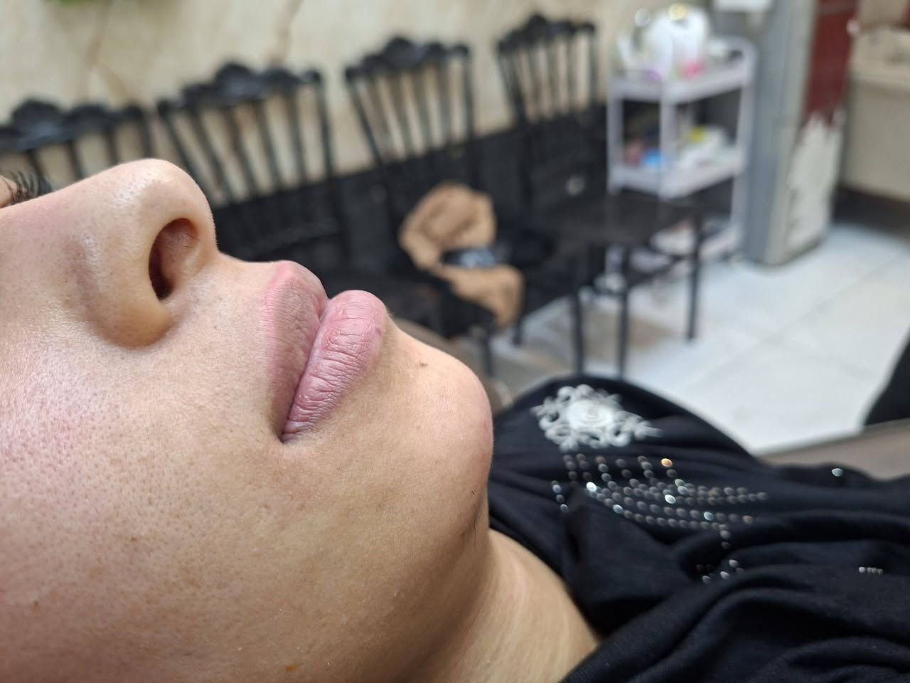 قبل وبعد • فلر • جلسة