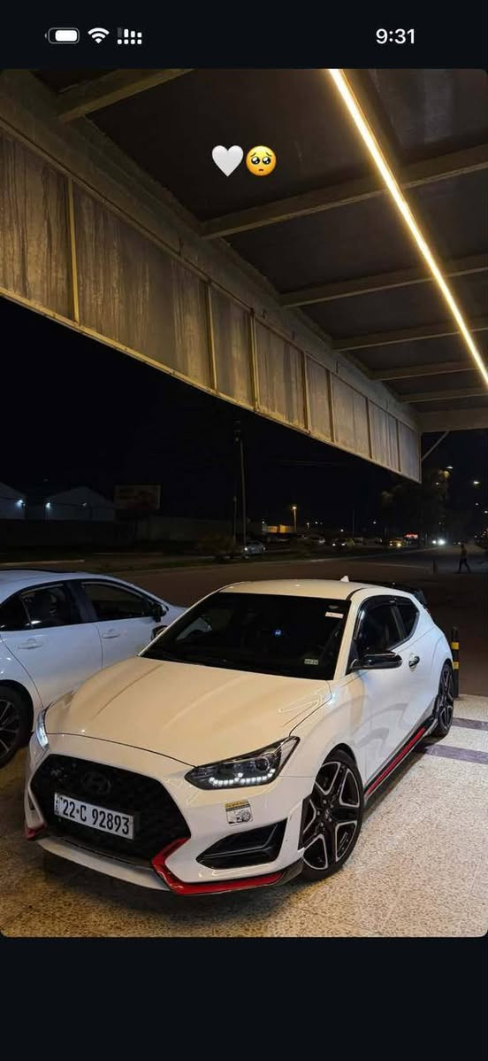 للبيع فولستر N 🚘
مواصفات فول من عدا الفتحة
سيارة كير عادي 
محرك 20 تيربو 
سيارة بدون ضرر كلين 
للاستفسار الاتصال على الرقم ***********
